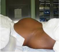 Simple Solution To Get Rid Of Fibroid