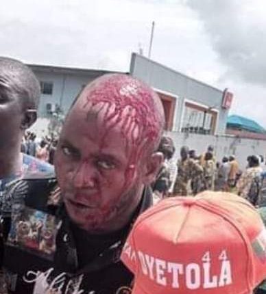 Pandemonium at Osun APC secretariat as Oyetola’s loyalist soaked in his blood