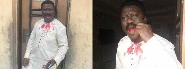 Lagos councilor beats APC chairman over bag of rice
