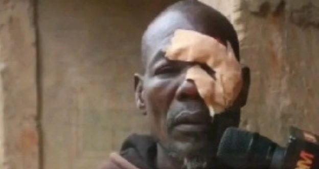 Drama as Father of 6 loses eye in fight over dog meat