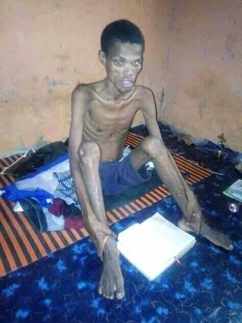 Drama as University Student Hospitalized After Fasting For 41 Days