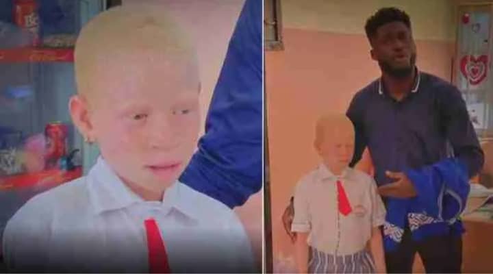 Albino girl bags scholarship after being denied access to school