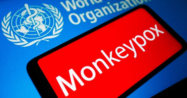 WHO Declares Monkeypox Global Health Emergency