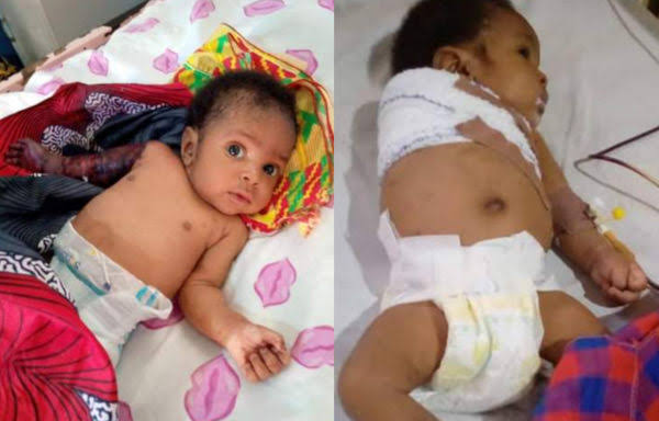 Oh no! Man allegedly breaks arm of his 2-month-old baby for disturbing his sleep