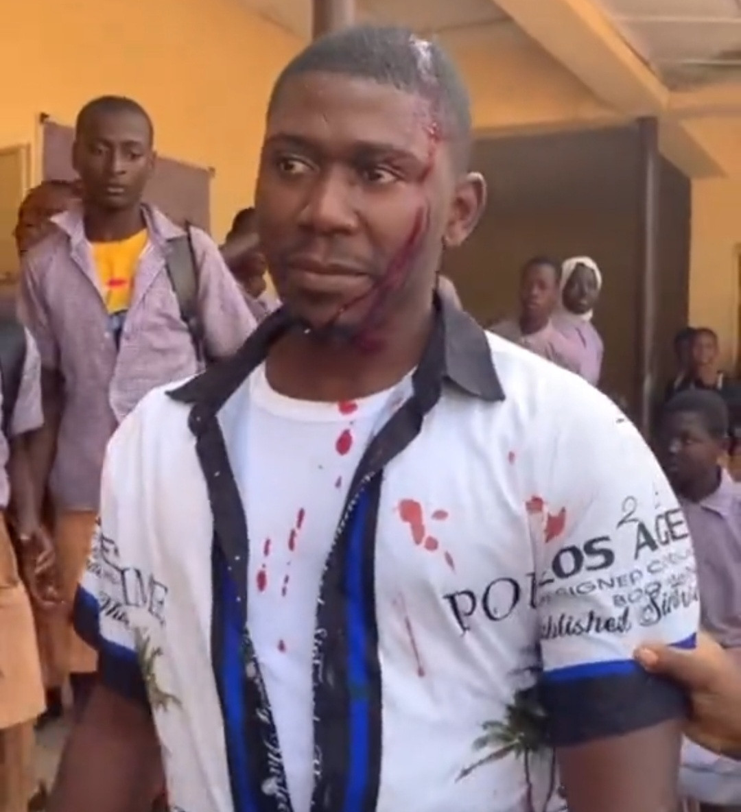 Secondary School Students Attack Corps Member In Osun (Graphic Photo)