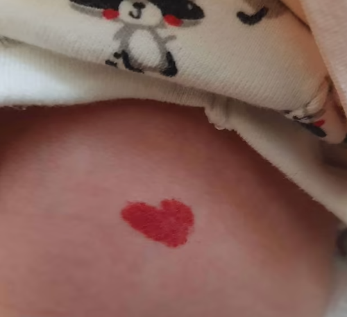 PHOTOS: Baby born in February with heart-shaped red birth mark