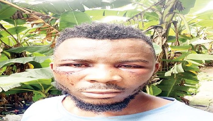 Ogun: Man protesting police harassment brutalised 
