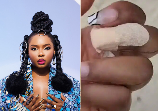 Yemi Alade survives auto accident in Spain