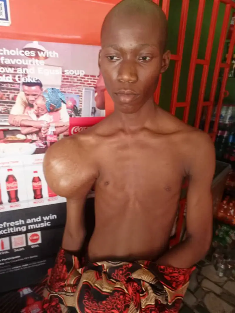 JUST IN: 15-year-old Bello seeks N1.16m for cancer treatment