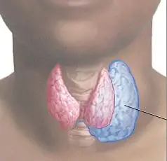 Silent crisis: 6m Nigerians have thyroid disease— Experts