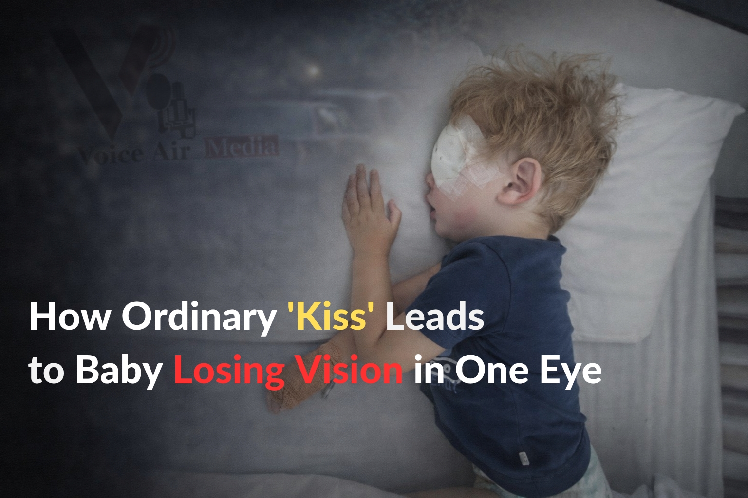 How Ordinary ‘Kiss’ Leads to Baby Losing Vision in One Eye